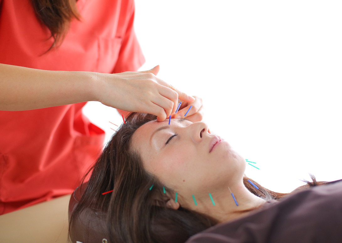 新潟県新潟市の女性のための鍼灸サロンmamariの美容鍼