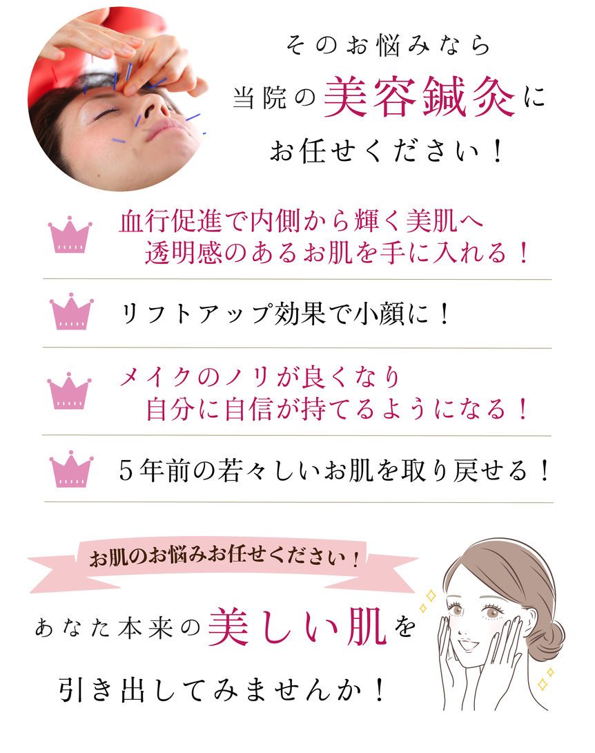美容鍼で美肌・小顔・リフトアップ・化粧乗りを改善